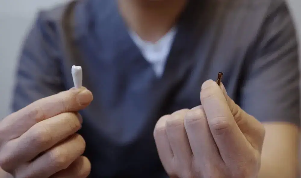 Dental Implants