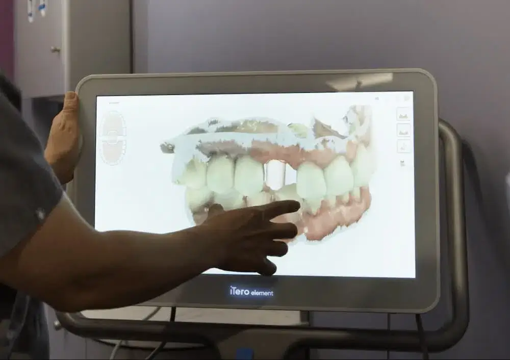 Dental Implants at Brookline Dental Specialists